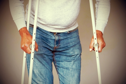 Hip Fractures Rehabilitation